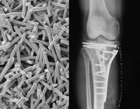 35 Human Body Can Absorb Biologically Active Special Glass Fibers